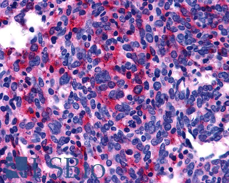 PathPlus™ EDNRB / Endothelin B Receptor Antibody (N-Terminus)