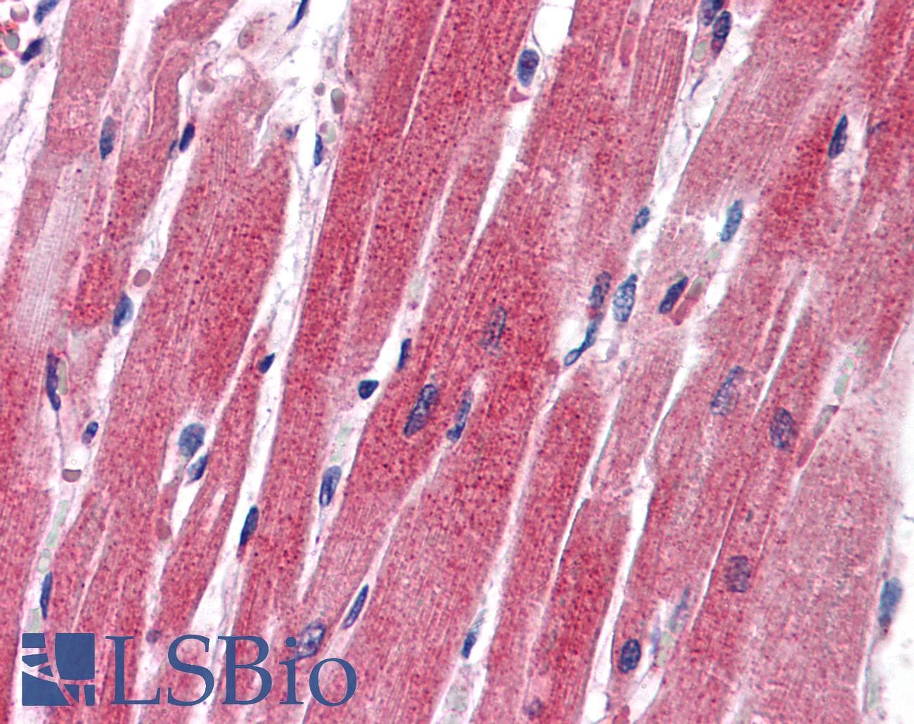 SNAI2 / SLUG Antibody (aa92-141)