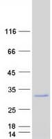Human FHL2 Protein (Recombinant Myc-DDK (Flag))