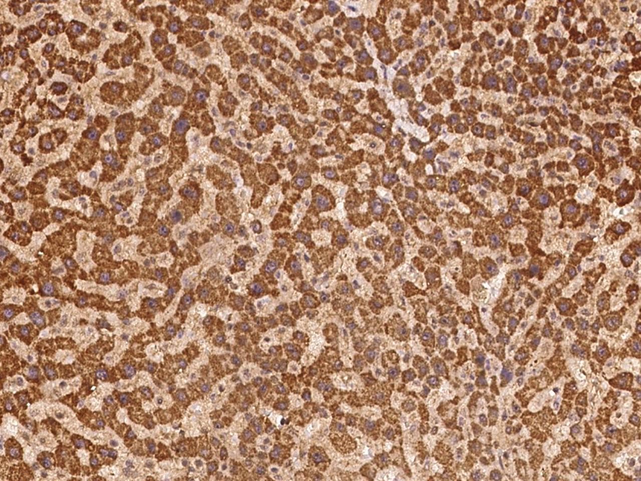 TRIM5 Antibody