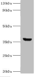 ANXA8L1 Antibody (aa1-276)