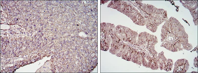 CD276 / B7-H3 Antibody (clone 6A1)