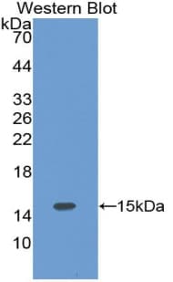 CFB / Complement Factor B Antibody (aa269-382, PE)