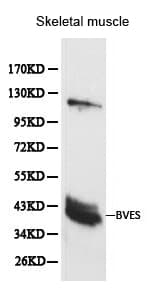 Polyclonal Rabbit anti-Human BVES Antibody (IHC, WB)