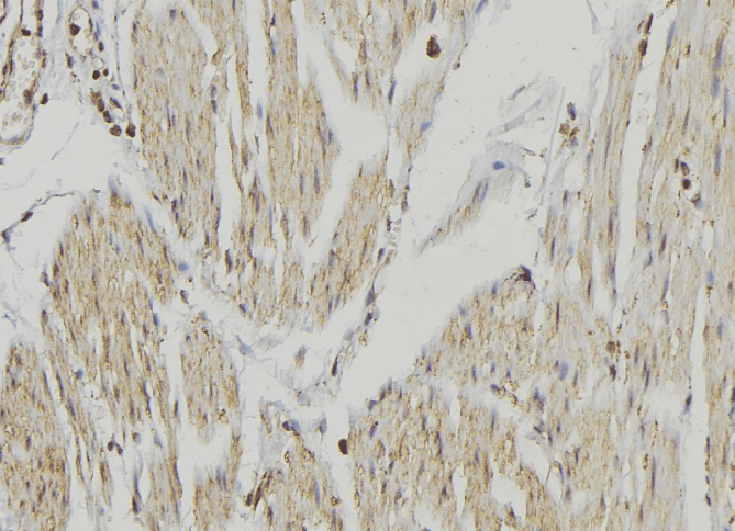 Cytochrome P450 2R1 / CYP2R1 Antibody