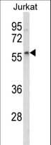 IHC-plus™ Polyclonal Rabbit anti-Human SPRED1 Antibody (IHC, WB)