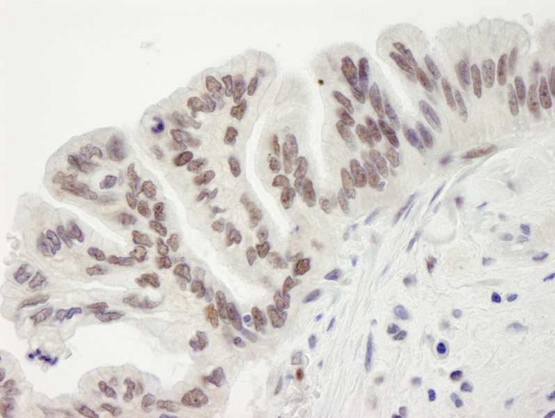 RBBP7 / RbAp46 Antibody (aa375-C-term)