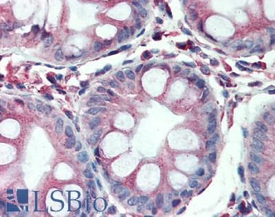 IHC-plus™ Polyclonal Rabbit anti-Human TSG101 Antibody (aa225-275, IHC, WB)