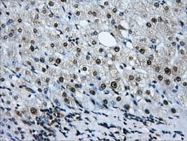 LOX / Lysyl Oxidase Antibody (clone OTI8G5)