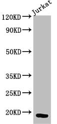 CD247 / CD3 Zeta Antibody
