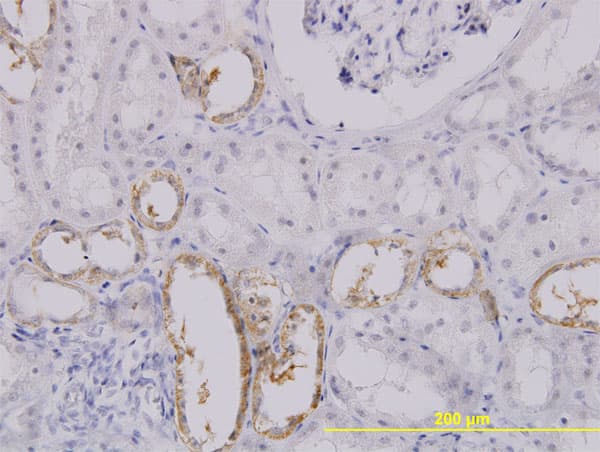 Monoclonal Mouse anti-Human SLC25A11 Antibody (clone 3G4, IHC, WB)