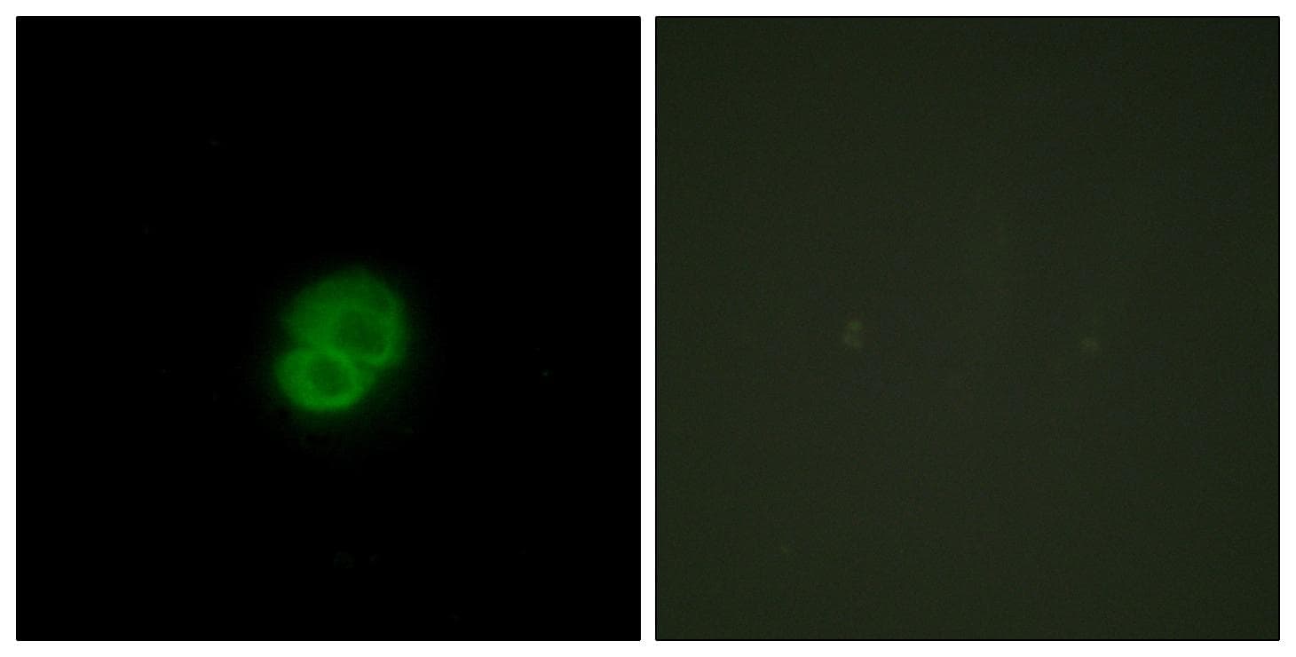 Polyclonal Rabbit anti-Human ARMCX2 Antibody (IF, WB)
