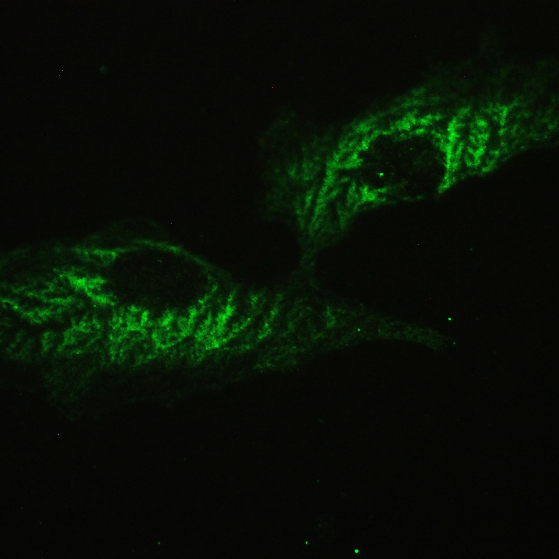 ATXN2 / SCA2 / Ataxin-2 Antibody (aa1293-1313)