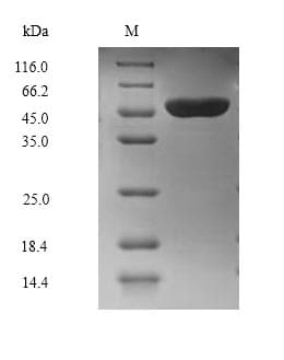 Mouse E6AP / UBE3A Protein (Recombinant DDK,C-terminus)