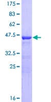 Human BOD1 Protein (Recombinant GST)