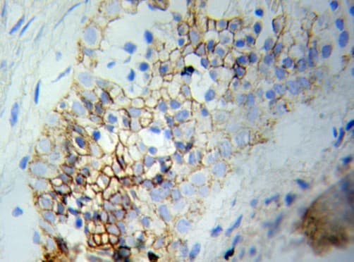 Polyclonal Rabbit anti-Human ERK1 + ERK2 Antibody (IHC, WB)