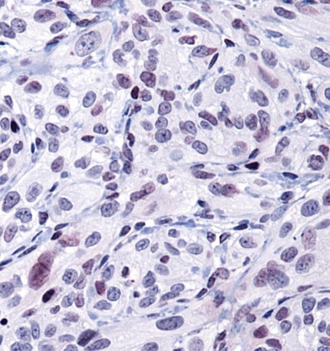 hsp90aa1.1 Antibody