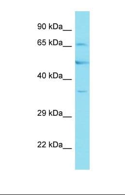 Polyclonal Rabbit anti-Human FBXO46 Antibody (aa366-415, WB)
