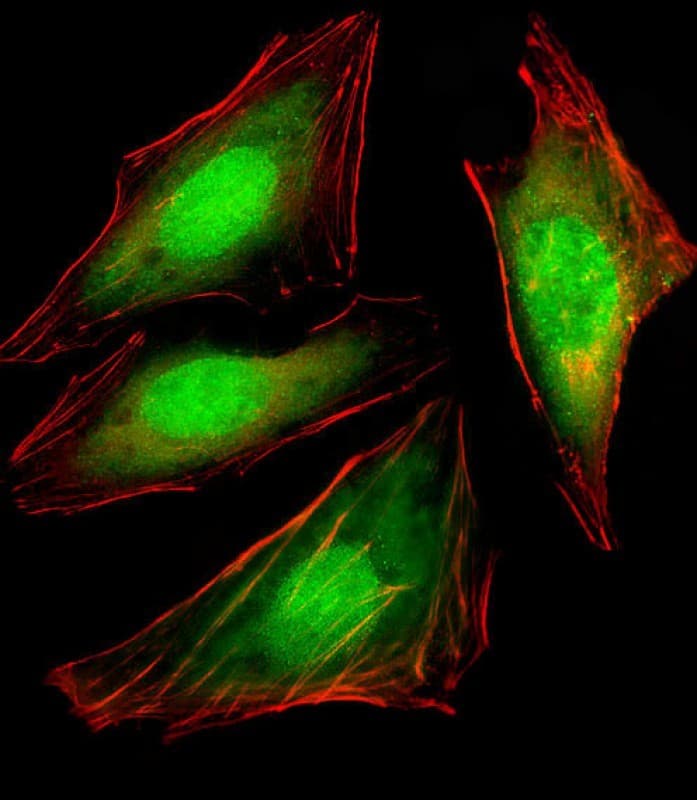 VCP Antibody (clone 1563CT163.48.77)