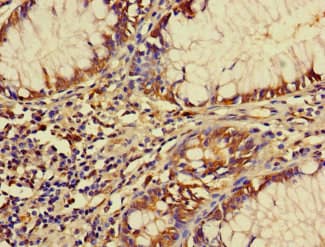 Polyclonal Rabbit anti-Human FBXW12 Antibody