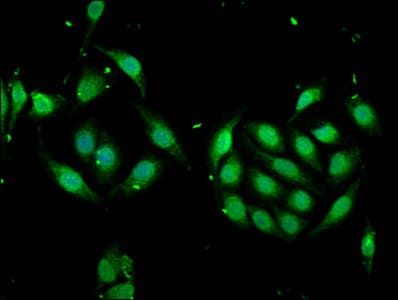MSI1 / Musashi 1 Antibody