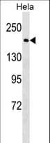 BRCA1 Antibody (aa443-472)