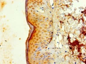 IL1F10 Antibody (aa1-152)