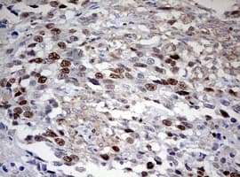 Monoclonal Mouse anti-Human TOP2A / Topoisomerase II Alpha Antibody (clone OTI2F8, aa1100-1531, IHC, WB)