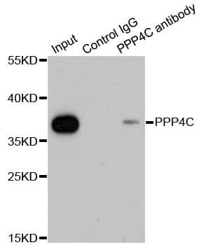 Polyclonal Rabbit anti-Human PPP4C Antibody (IF, WB)