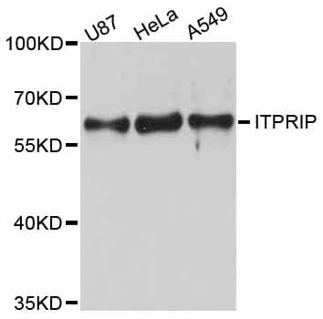 Polyclonal Rabbit anti-Human ITPRIP Antibody (WB)