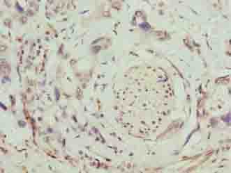 SLC26A8 / TAT1 Antibody
