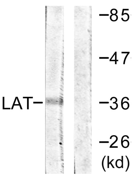 Polyclonal Rabbit anti-Human LAT Antibody (aa171-220, WB)