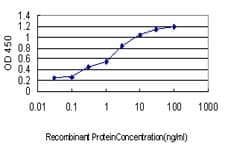 Monoclonal Mouse anti-Human PBX1 Antibody (clone 4A2, IHC, IF, WB)