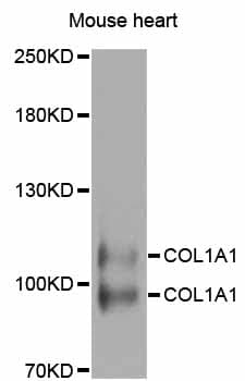 Polyclonal Rabbit anti-Human COL1A1 / Collagen I Alpha 1 Antibody (aa100-200, IHC, WB)