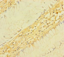 TM4SF5 Antibody (aa112-157)