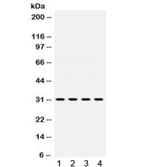 IGFBP3 Antibody