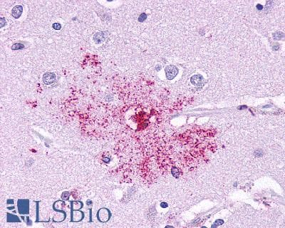 PathPlus™ Leukotriene B4 Receptor / BLT1 Antibody (Cytoplasmic Domain)
