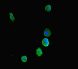 KDM5C / Jarid1C / SMCX Antibody