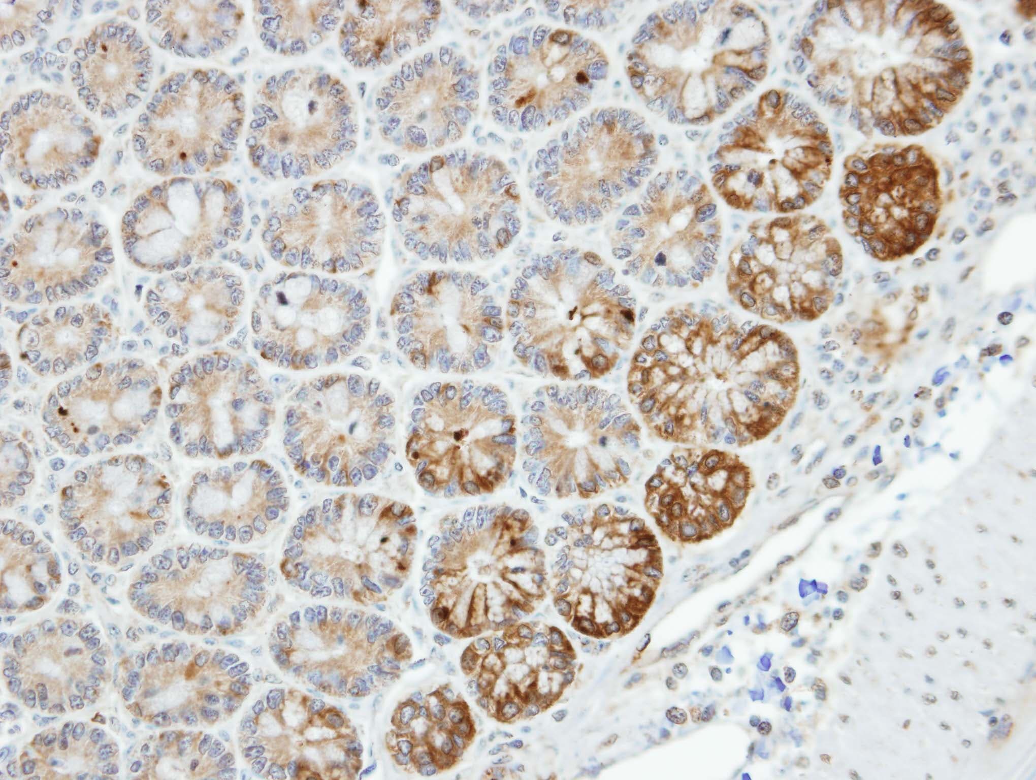 Polyclonal Rabbit anti-Human STK26 / MST4 Antibody (aa352-416, IHC, WB)