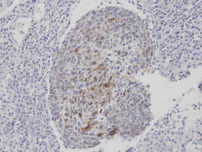 GOB5 / CLCA1 Antibody (aa542-633)
