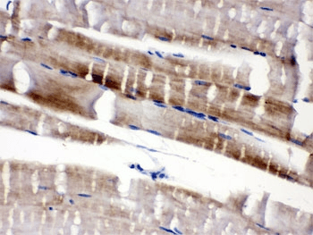 FABP3 / H-FABP Antibody (aa119-133)