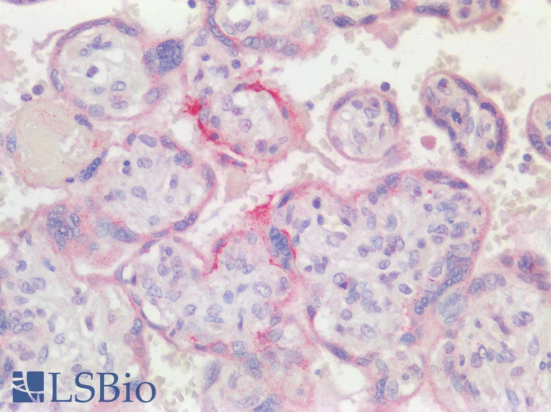 HAPLN1 Antibody (aa35-84)
