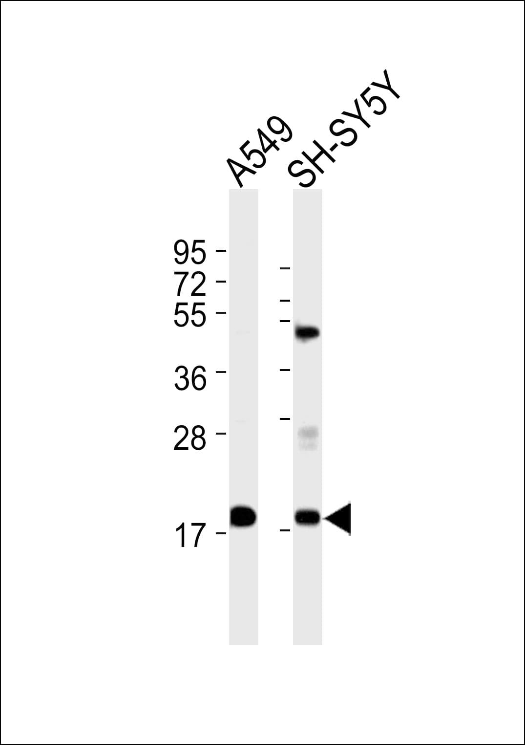 Polyclonal Rabbit anti-Human RPL28 / Ribosomal Protein L28 Antibody (WB)
