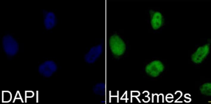 Polyclonal Rabbit anti-Human Histone H4 Antibody (Sym-Di-Methyl-Arg3, IHC, IF, WB)