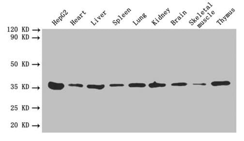 IHC-plus™ ANXA5 / Annexin V Antibody