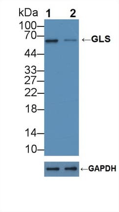 GLS / Glutaminase Antibody (aa31-253)