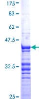 Human CDC20 Protein (Recombinant GST, N-terminus)