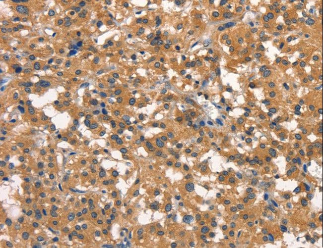 DNM2 / Dynamin-2 Antibody
