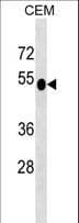 DUSP6 / MKP3 Antibody (aa59-88)