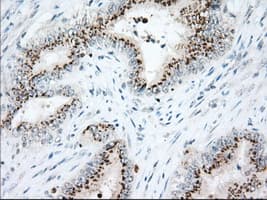 Heat Shock Protein 70 / HSPA1A Antibody (clone OTI3C6)